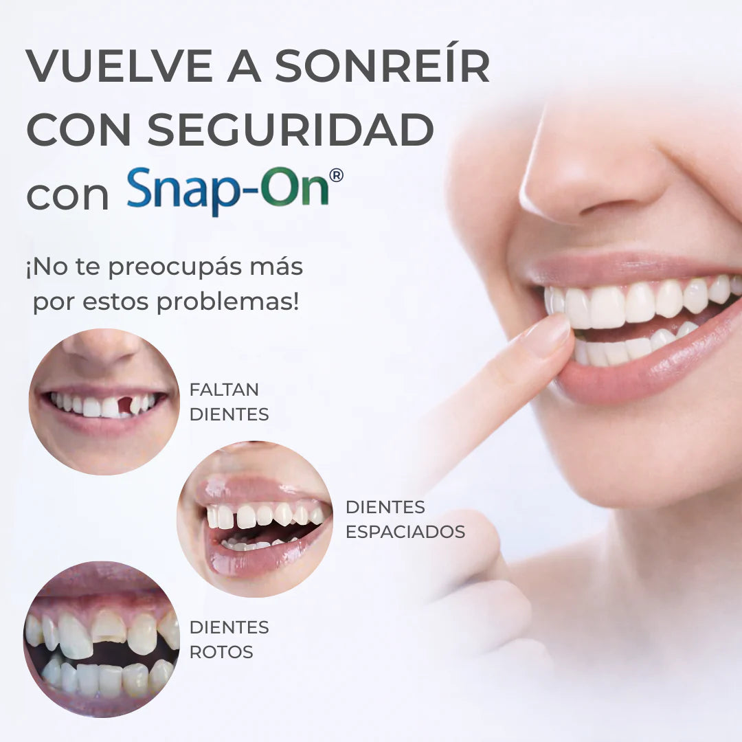 SNAP SMILE™ CARILLAS DENTALES REMOVIBLES