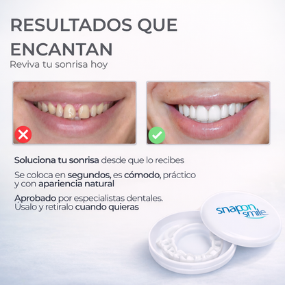 SNAP SMILE™ CARILLAS DENTALES REMOVIBLES