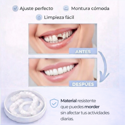 SNAP SMILE™ CARILLAS DENTALES REMOVIBLES